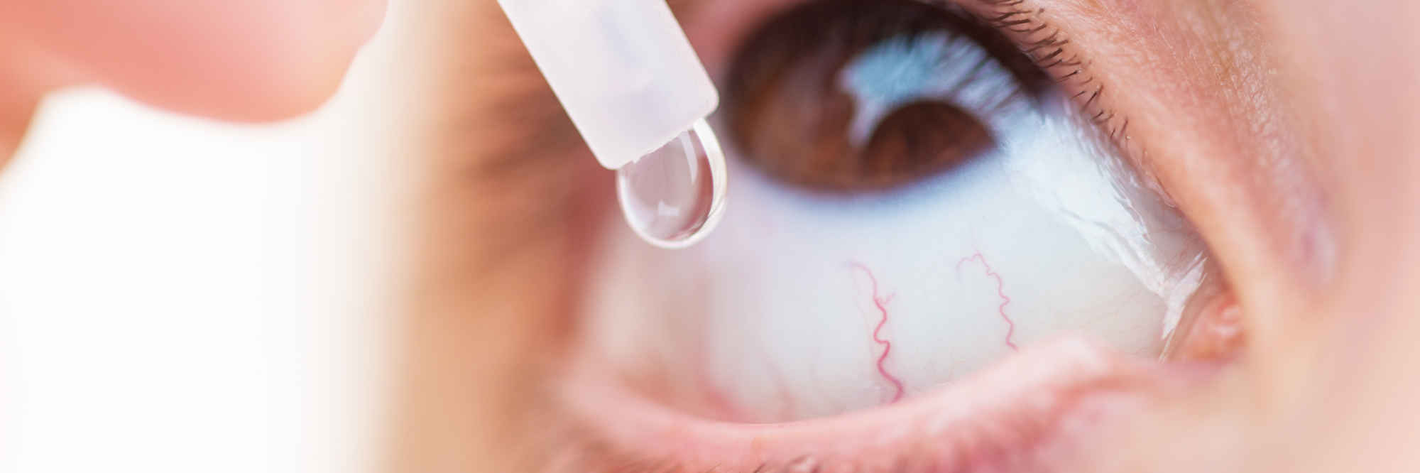 Questions about injections primary image