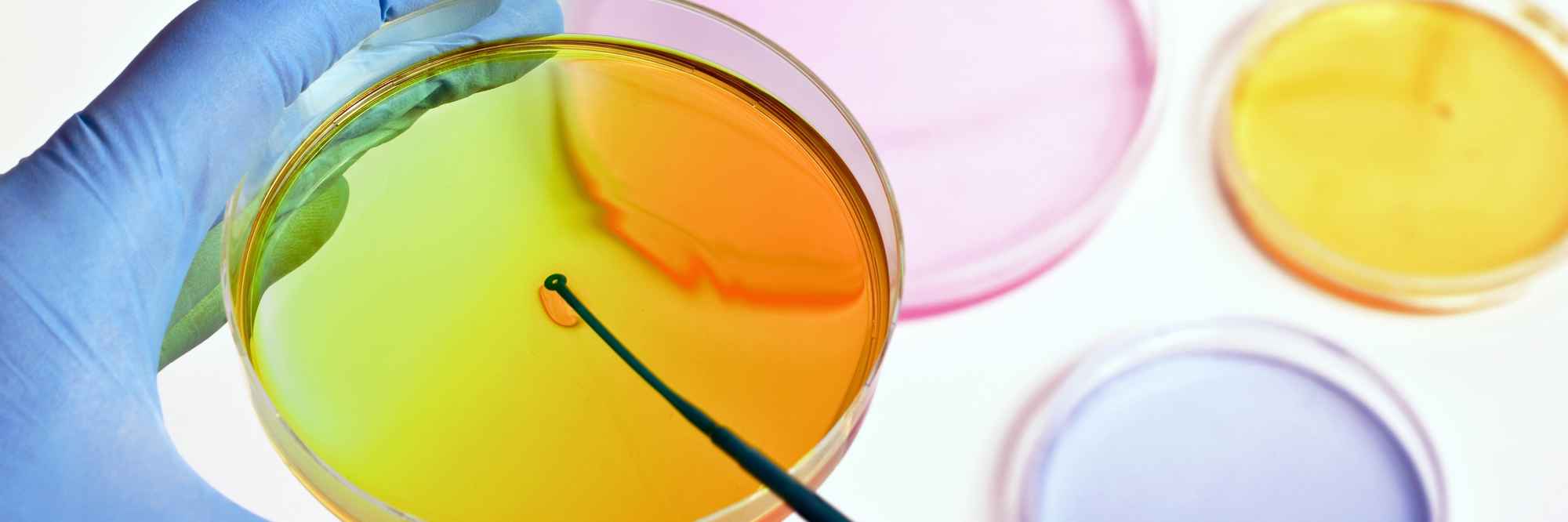 Stem cell therapy primary image